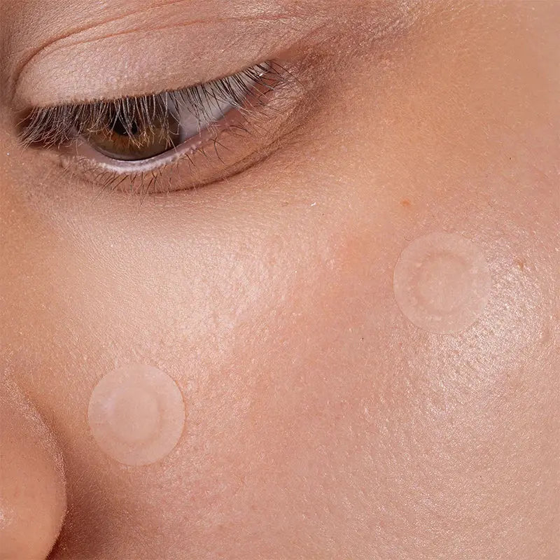 Scandy Spot the F Off Invisible Blemish Patches