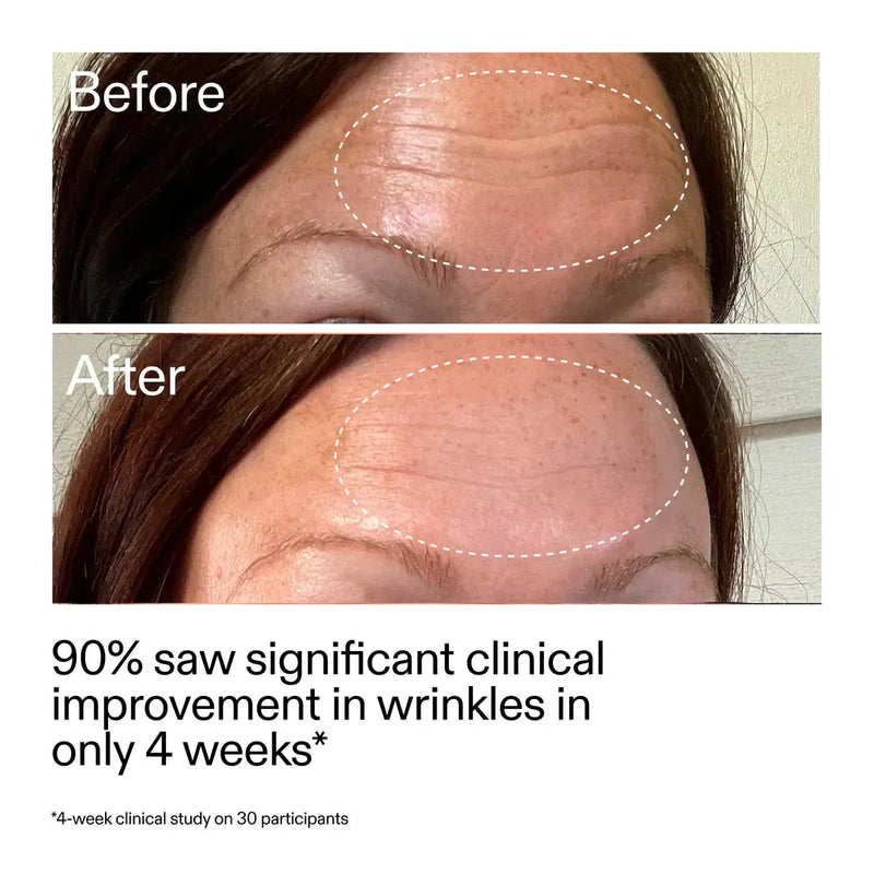 The Inkey List Starter Retinol Serum