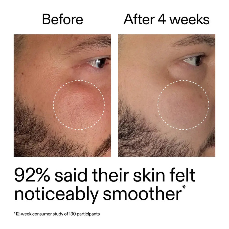 The Inkey List Starter Retinol Serum